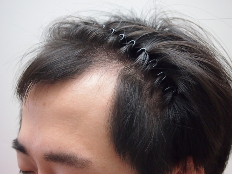 0P7312947.JPG