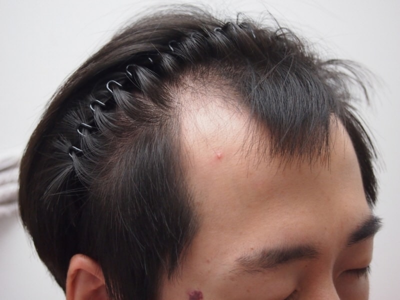 0P7312948.JPG