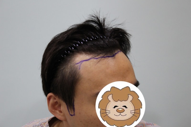 수술전2.jpg