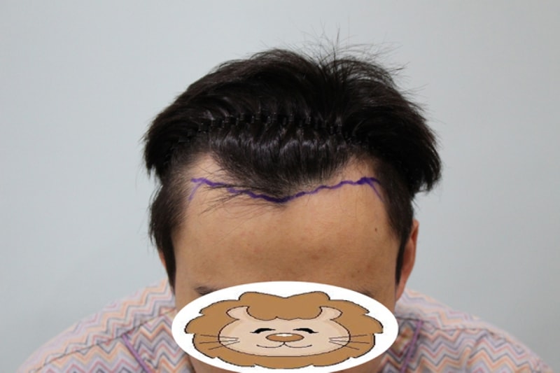 수술전3.jpg