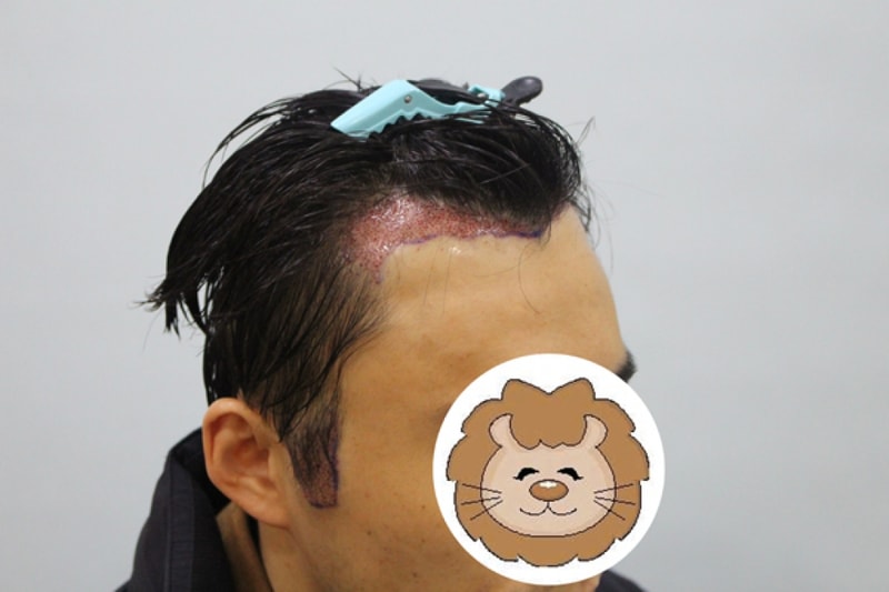 수술후2.jpg