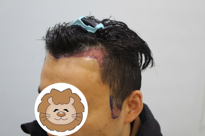 수술후1.jpg