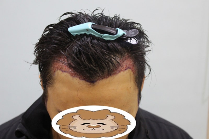 수술후3.jpg