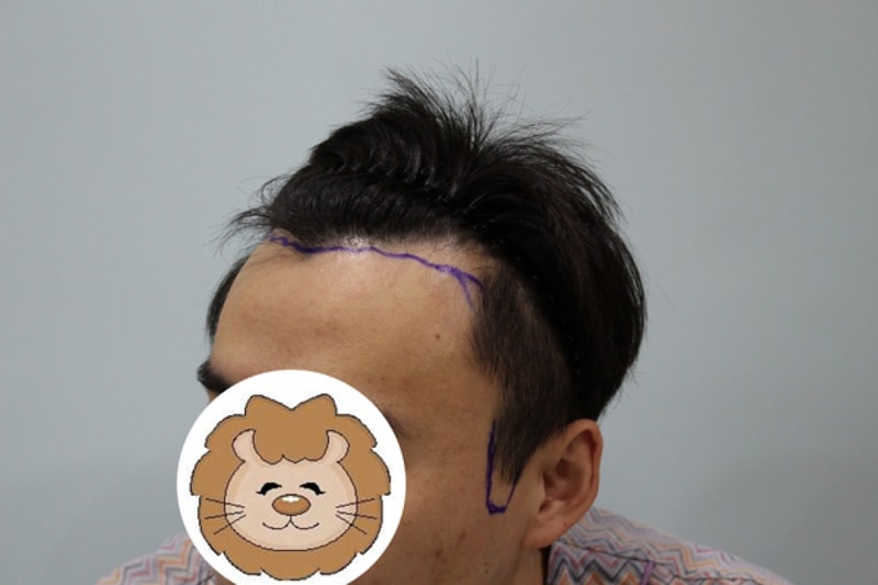 수술전1.jpg