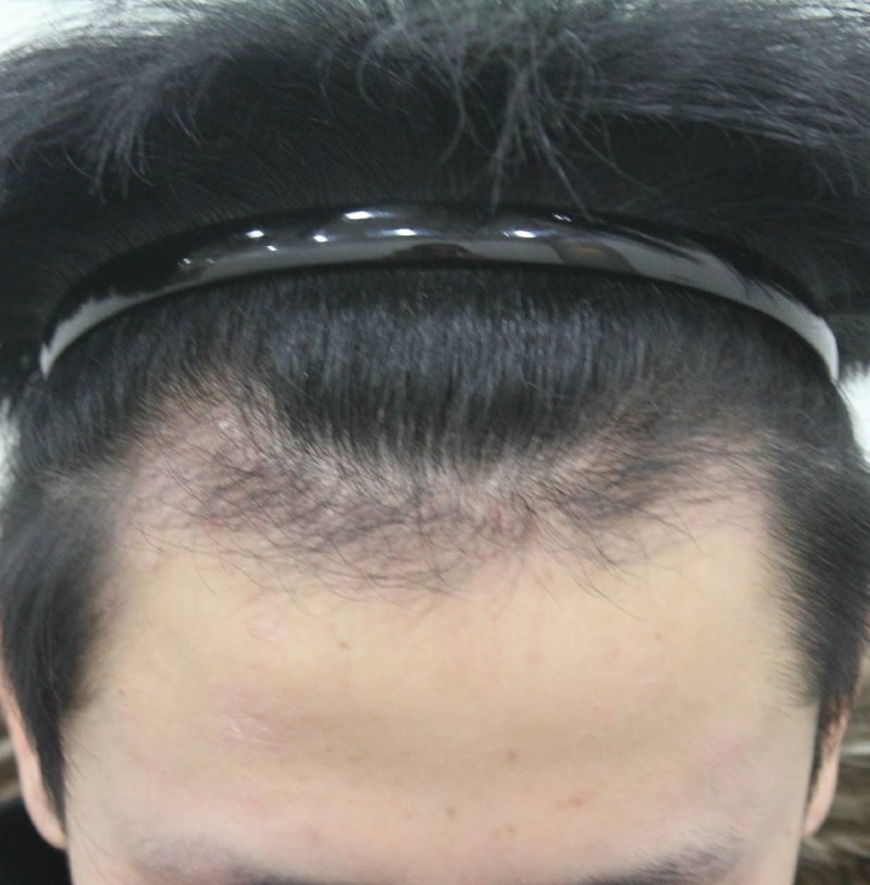 87.jpg
