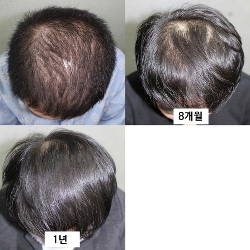 임성택-tile.jpg