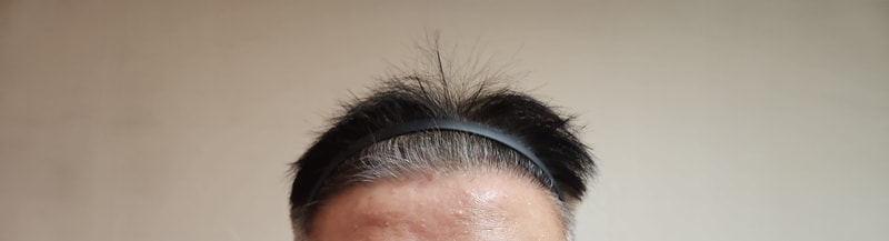 17개월경과2.jpg