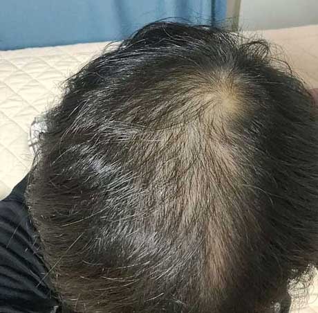 이식전휑하다.jpg