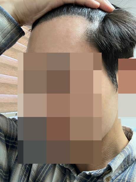 수새.jpg