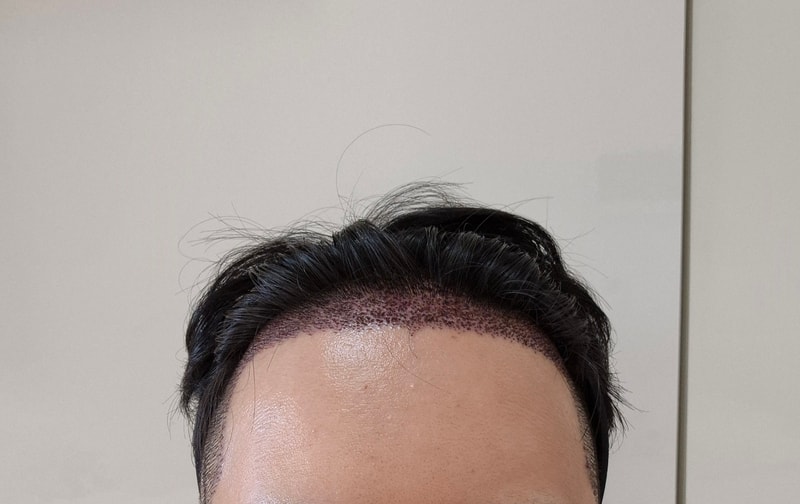 후_정면.jpg