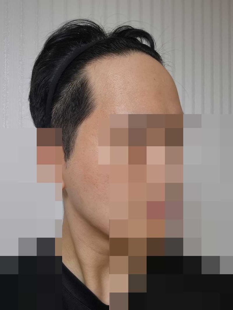 벌써8개월전.jpg