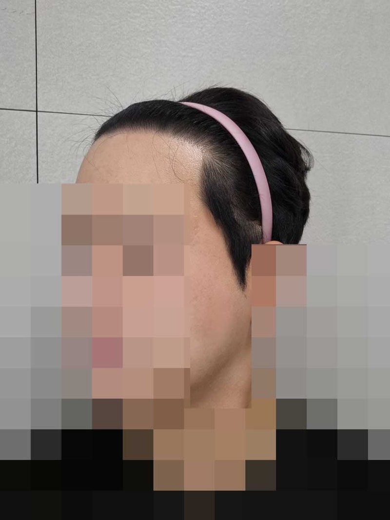 마니자랐다.jpg