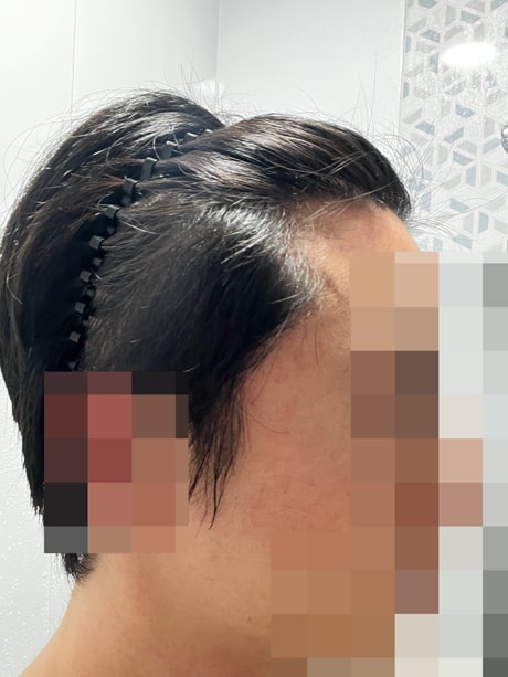 11달정두.jpg