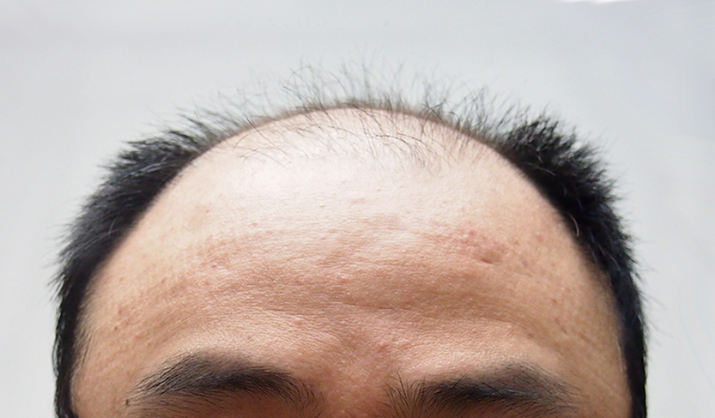 4d83659a801bd24f81f26a2ed35f34f2.png