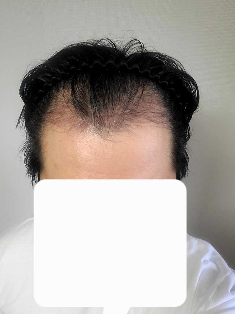 3댤.jpg