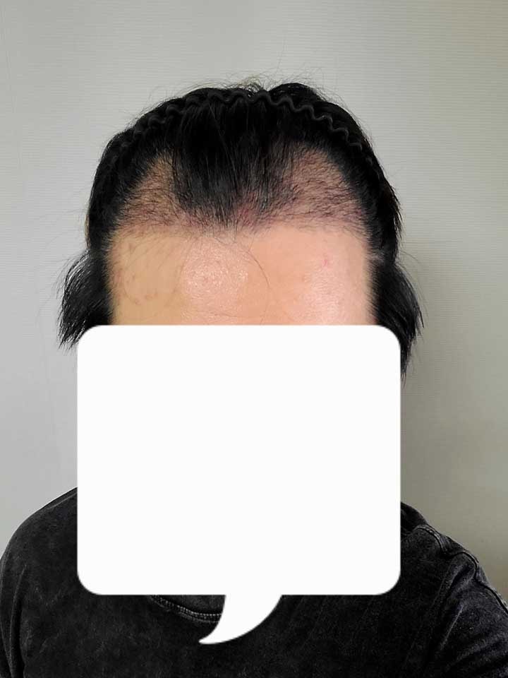 1뎔뎔.jpg