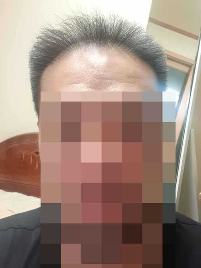 수술전1.jpg