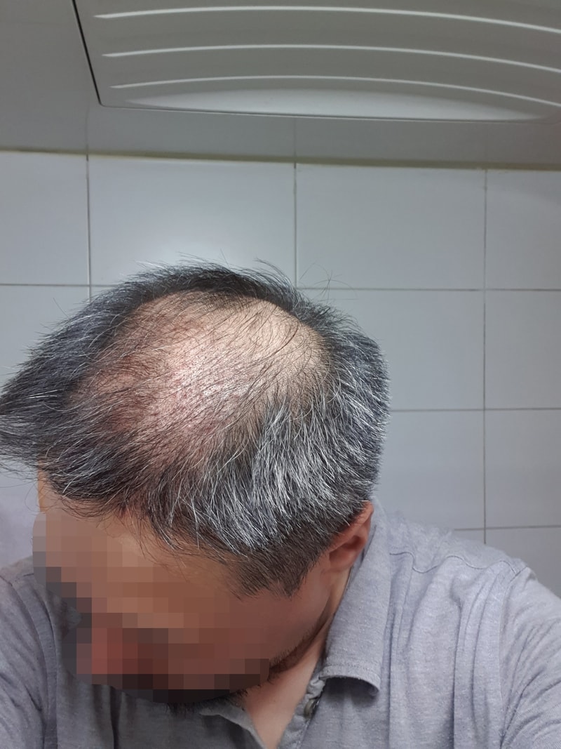 6주차 측면.jpg