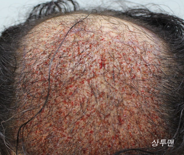 상투맨 1029_8.jpg