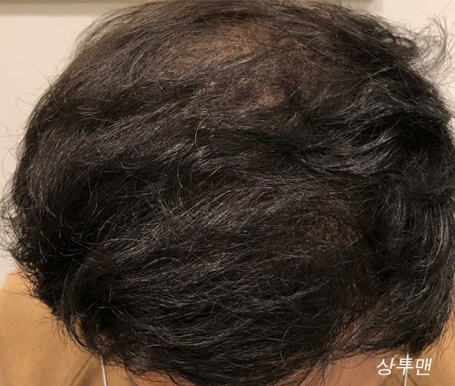 상투맨 1029_5.jpg
