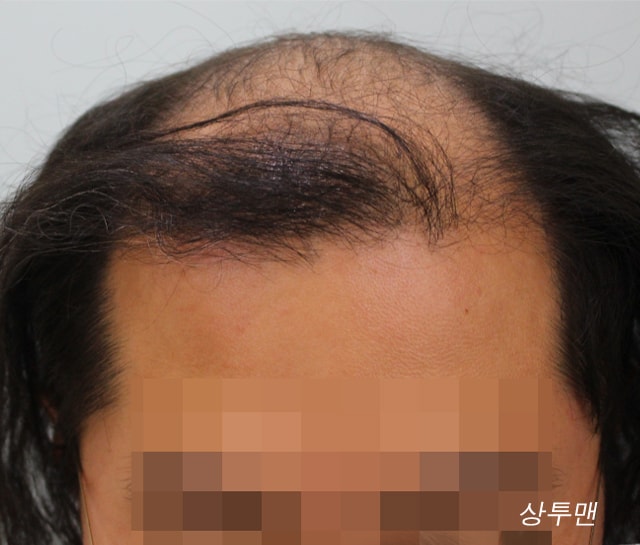 상투맨 1029_6.jpg