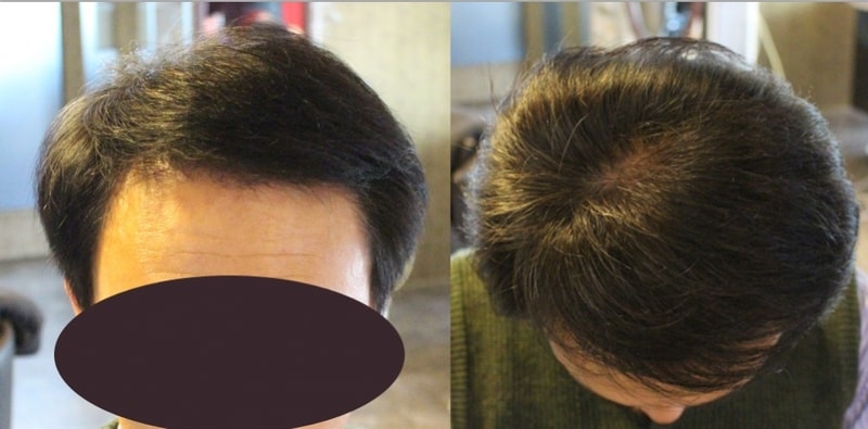 5개월후2.jpg