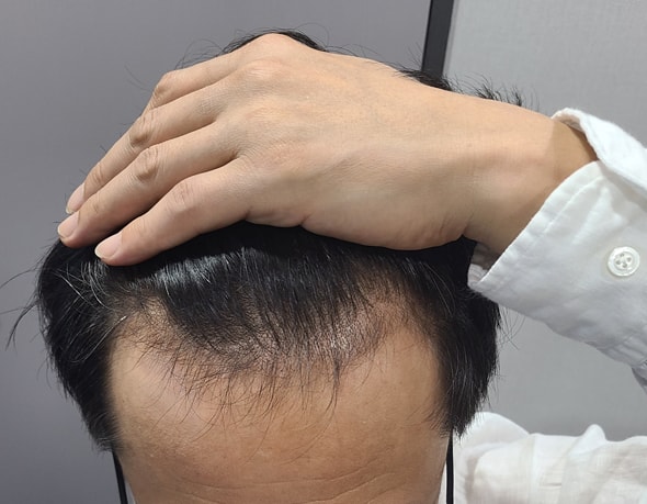 before.jpg