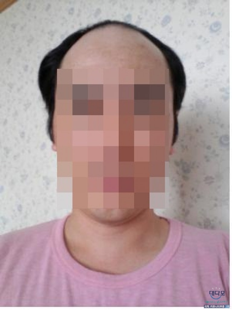 6개월차 다나후기입니다~