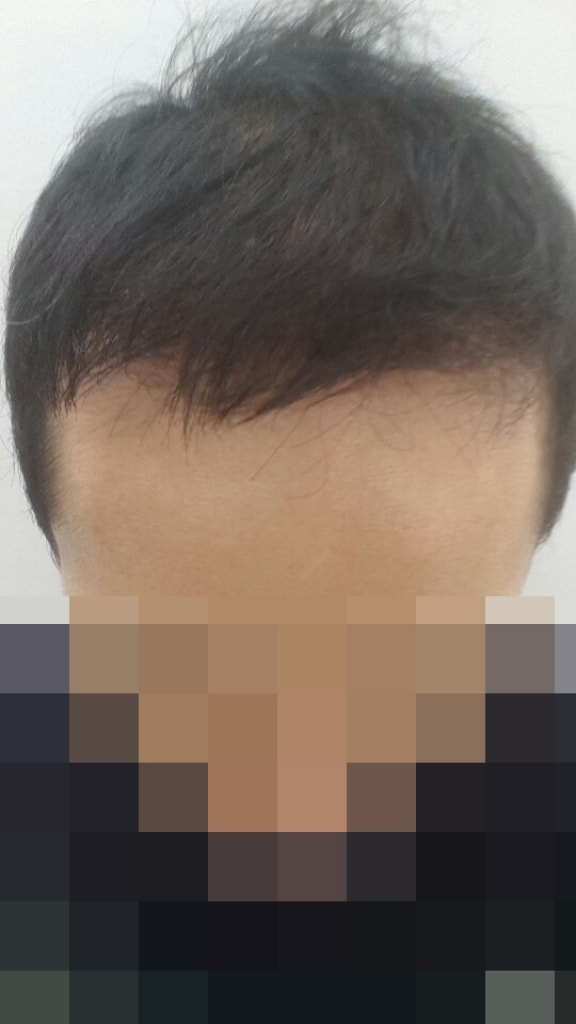 12개월.jpg