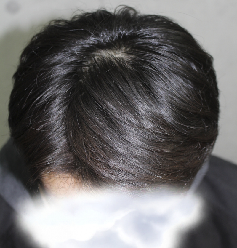 KakaoTalk_20170821_141859204.png