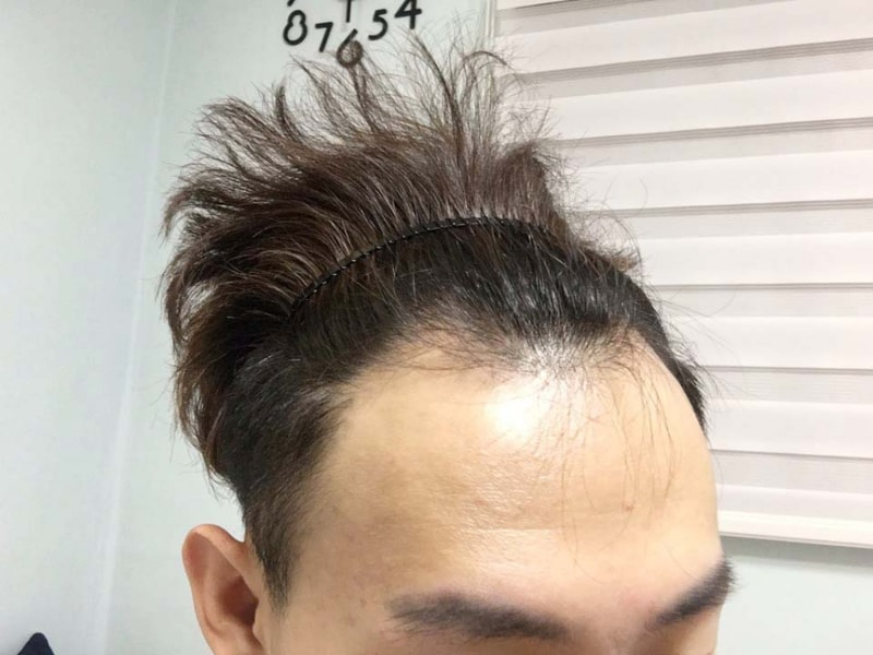 전2.jpg