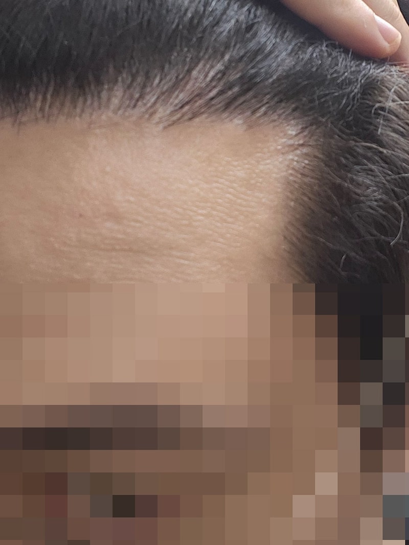 오른쪽.jpg