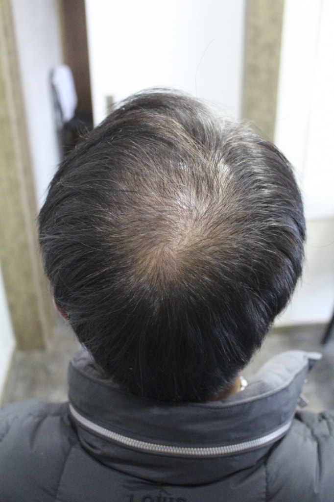 수술후_1.jpg
