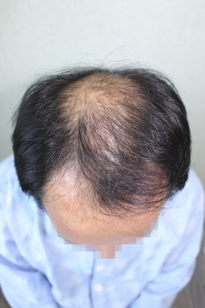 수술전_2.jpg