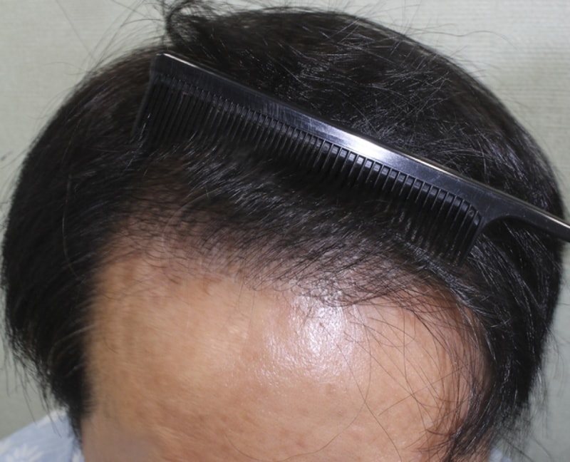 수술후_2.jpg