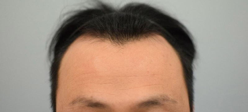 1년이 지난 후기 사진