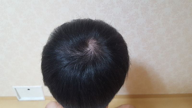 KakaoTalk_20180909_201200950.jpg