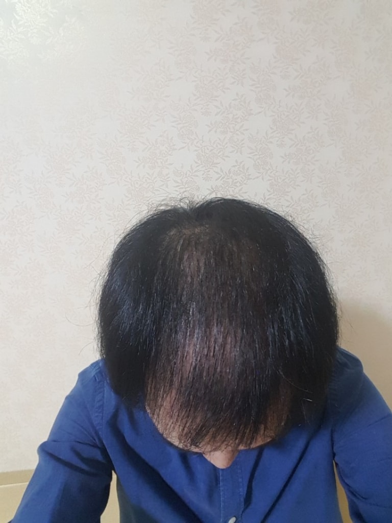 KakaoTalk_20170911_231755363.jpg
