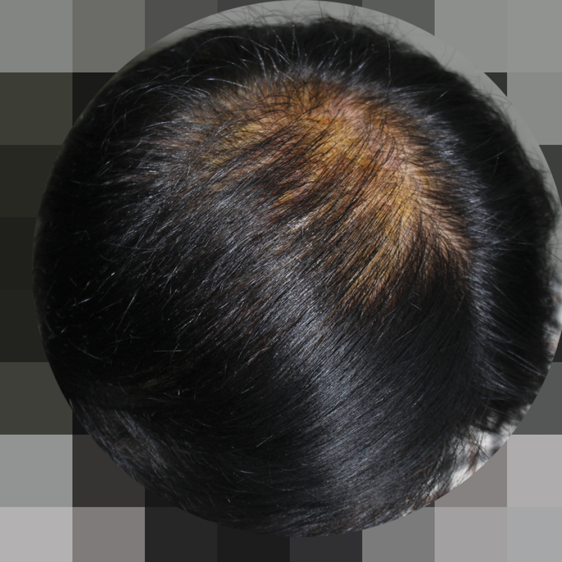 IMG_6605_8개월.png