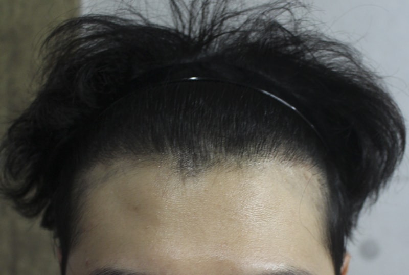 이식이이이이이 4.jpg