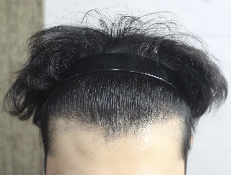 이식이이이이이 6.jpg