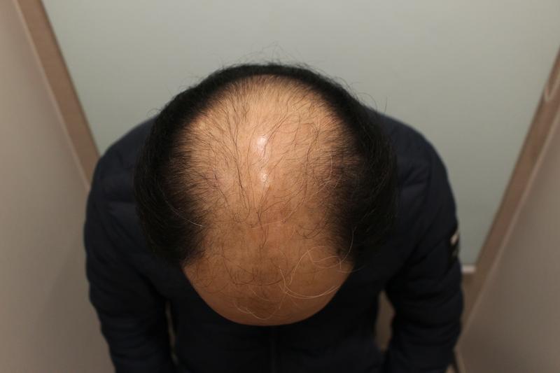 수술전 1.JPG