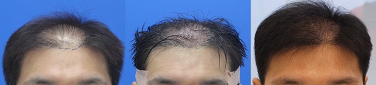 포토후기 이미지