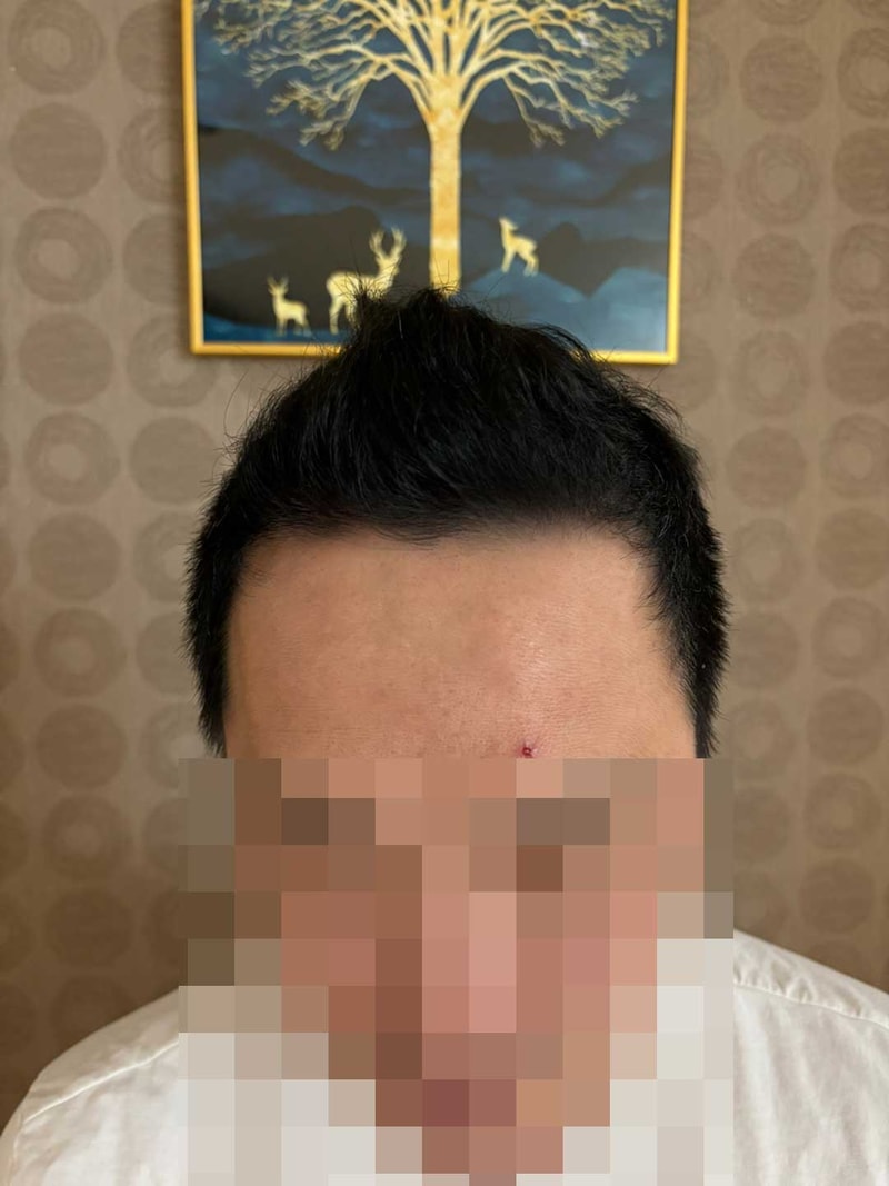 포토후기 이미지