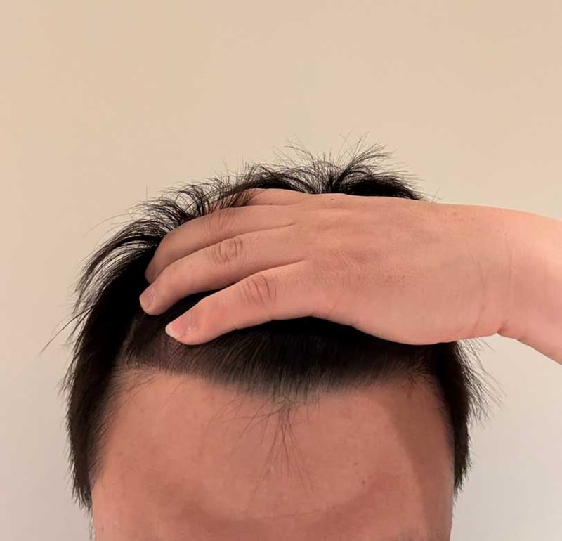 6개월정면.jpg