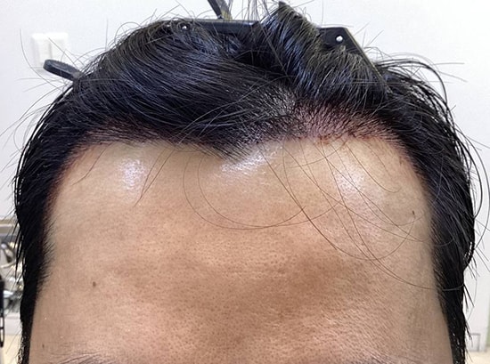 포토후기 이미지