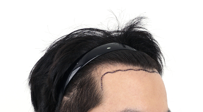 3.png