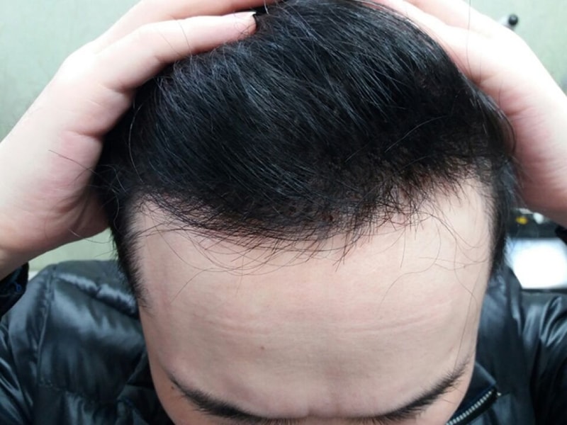 수술후1.jpg
