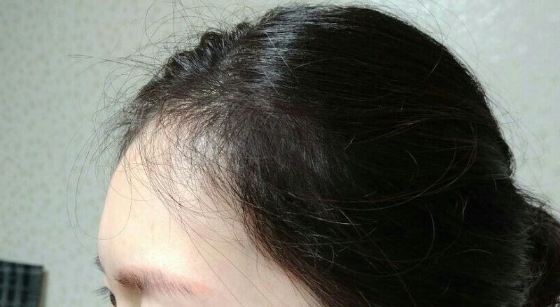 KakaoTalk_Moim_5SdY6oNQM3YMy7wnXAedjk237YQZBn.jpg