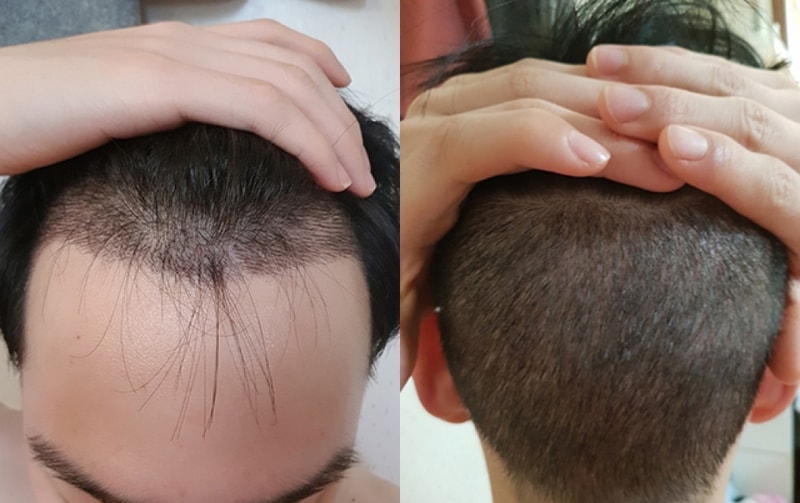 10일.jpg